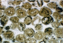 Zahlreiche Dolomitgesteine des Oberen Muschelkalks werden durch winzige schalige Kügelchen, sogenannte Ooide, aufgebaut. Bildbreite etwa 3 mm.